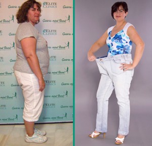 Gastric Band cost is far more than the Gastric Mind Band! Gastric Band Cost