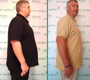 Gastric Band Reviews Gastric Band Reviews