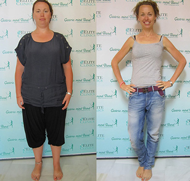 weight loss success stories with hypnosis