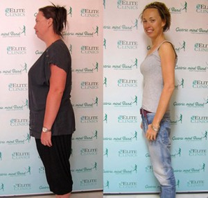 Gastric Band Pills Gastric Band Pills