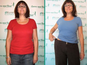Gastric Band Side Effects Gastric Band Side Effects