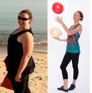 Gastric Sleeve Surgery Katie lost 100 pounds with the Gastric Mind Band Treatment.